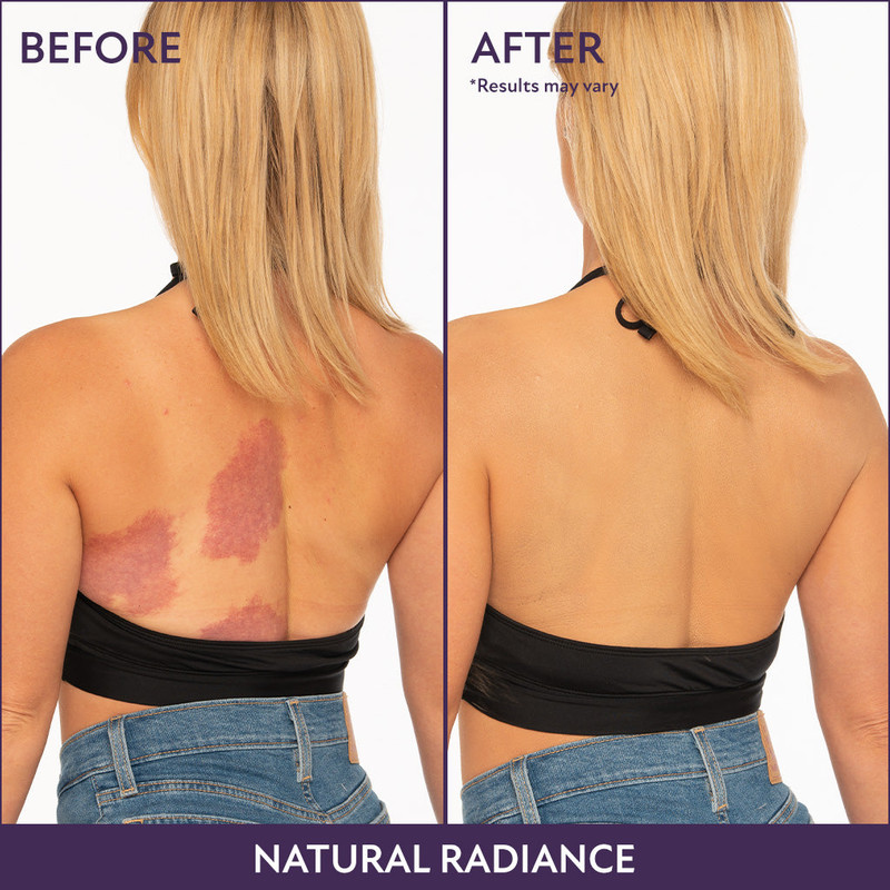 🎉Last Day 49% Off🎁 Full Body Complexion Perfector - with FREE BRUSH